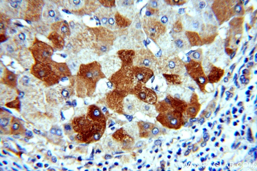 [15255-1-AP-150UL] H6PD Polyclonal antibody