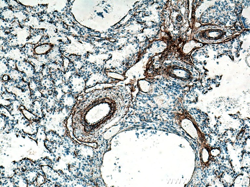 [15257-1-AP-20UL] Elastin Polyclonal antibody