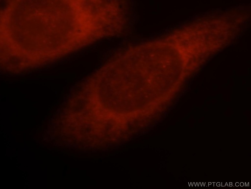 [15261-1-AP-150UL] PSMD13 Polyclonal antibody