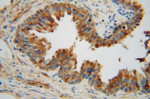 [15262-1-AP-20UL] TMOD2 Polyclonal antibody