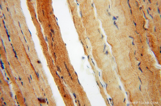 [15263-1-AP-20UL] KIF1B Polyclonal antibody