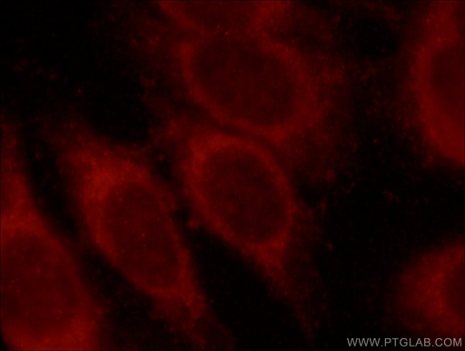 [15265-1-AP-150UL] MLYCD Polyclonal antibody