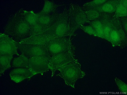 [15268-1-AP-150UL] S6K2 Polyclonal antibody
