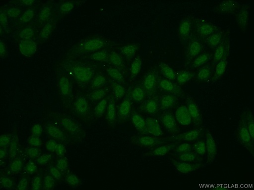 [15273-1-AP-20UL] POP4 Polyclonal antibody