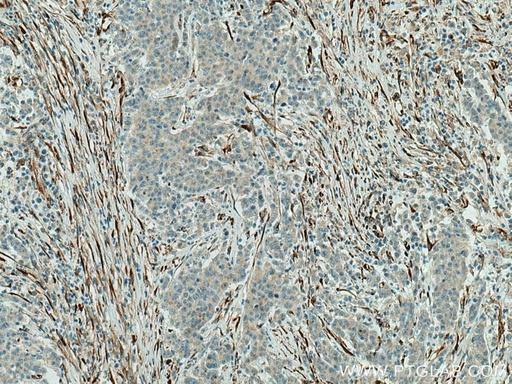 [15274-1-AP-20UL] SPARC Polyclonal antibody