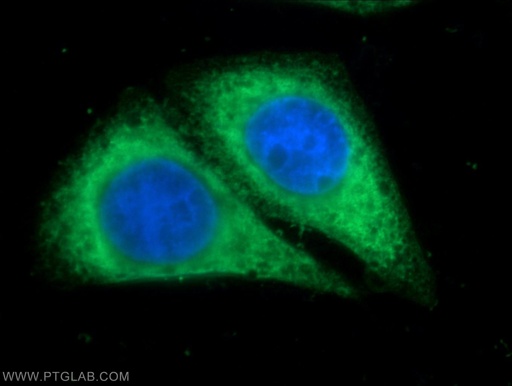 [15275-1-AP-150UL] VAPA Polyclonal antibody