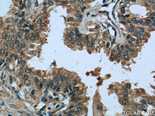[15276-1-AP-20UL] EIF1 Polyclonal antibody