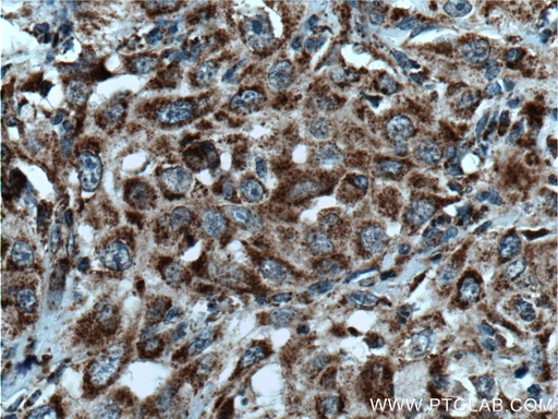[15279-1-AP-20UL] DHRS4 Polyclonal antibody