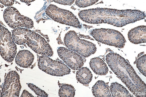 [15280-1-AP-150UL] ATP6V1E1 Polyclonal antibody