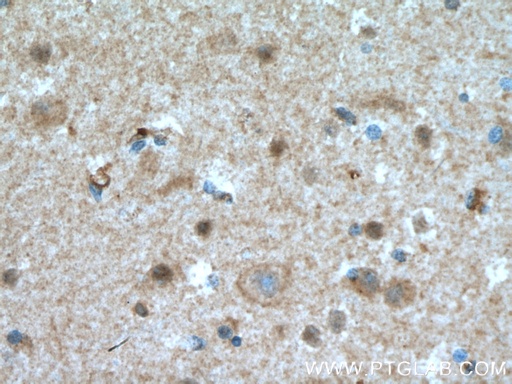 [15283-1-AP-150UL] HJURP Polyclonal antibody