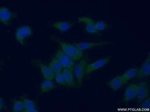 [15284-1-AP-20UL] GALK1 Polyclonal antibody