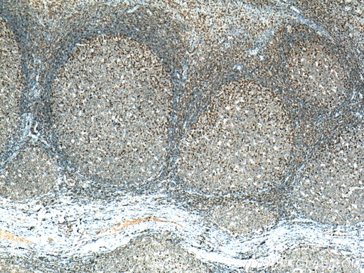 [15286-1-AP-150UL] PTPN7 Polyclonal antibody