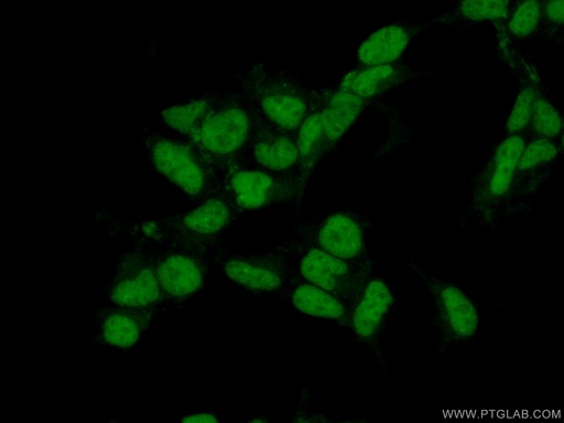 [15287-1-AP-20UL] HSPB8 Polyclonal antibody