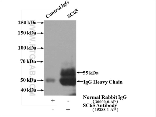 [15288-1-AP-150UL] SC65 Polyclonal antibody
