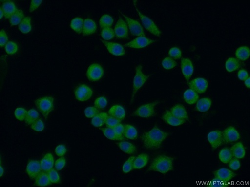 [15289-1-AP-150UL] TXNL1 Polyclonal antibody