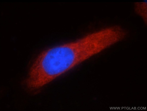[15293-1-AP-150UL] ARFGAP3 Polyclonal antibody