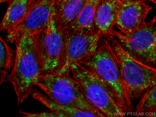 [15294-1-AP-150UL] ADRP/Perilipin 2 Polyclonal antibody