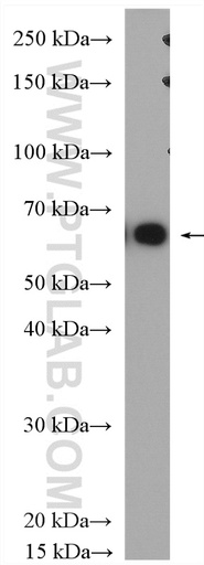 [15295-1-AP-150UL] MAGEA10 Polyclonal antibody