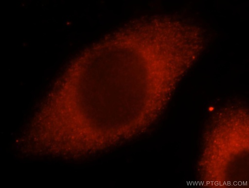 [15296-1-AP-150UL] CARS Polyclonal antibody