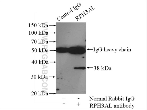 [15297-1-AP-150UL] RPH3AL Polyclonal antibody