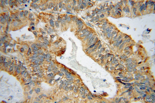 [15298-1-AP-150UL] GRB14 Polyclonal antibody