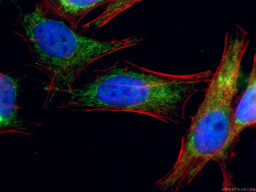[15301-1-AP-150UL] NDUFV2 Polyclonal antibody