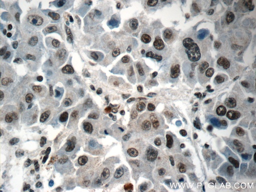 [15302-1-AP-150UL] HIST2H2AA4 Polyclonal antibody
