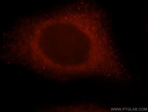 [15303-1-AP-20UL] GBP1 Polyclonal antibody
