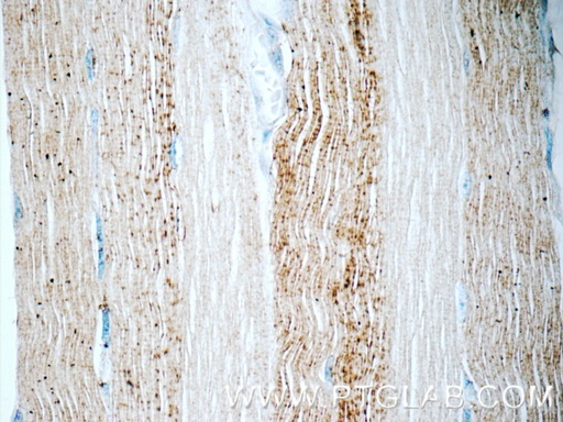 [15304-1-AP-20UL] ADAMTSL4 Polyclonal antibody