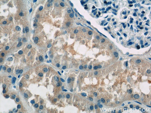 [15305-1-AP-150UL] ATP6AP1 Polyclonal antibody