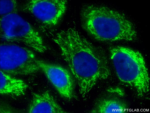 [15310-1-AP-20UL] ALDH2 Polyclonal antibody
