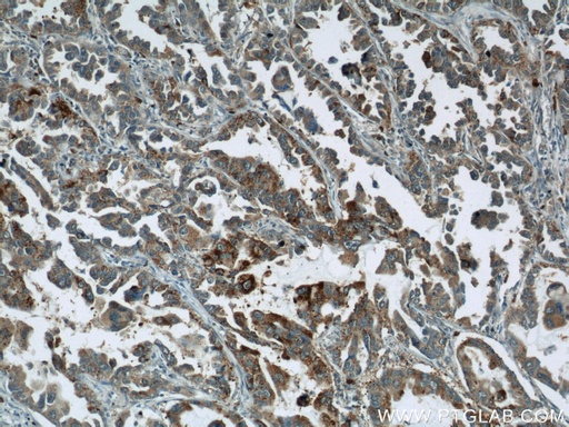 [15312-1-AP-150UL] STXBP2 Polyclonal antibody