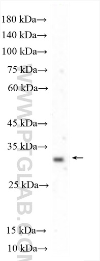 [15314-1-AP-20UL] TSPAN14 Polyclonal antibody