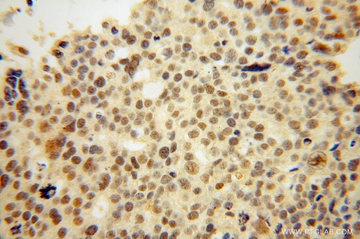 [15316-1-AP-150UL] THOC6 Polyclonal antibody