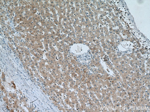 [15317-1-AP-150UL] SLC25A15 Polyclonal antibody