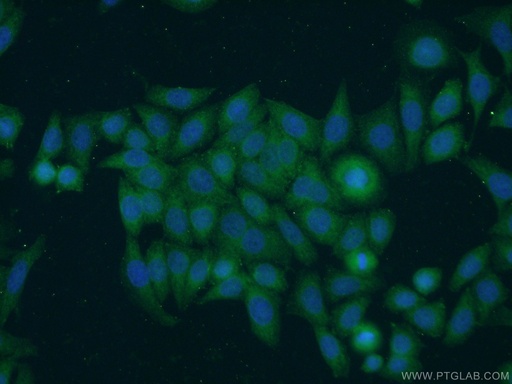 [15320-1-AP-20UL] TNFAIP1 Polyclonal antibody