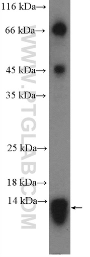 [15321-1-AP-150UL] PAM16 Polyclonal antibody
