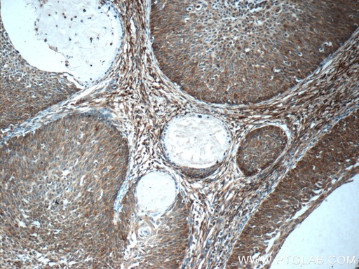 [15328-1-AP-20UL] SFRP4 Polyclonal antibody