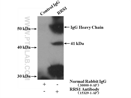 [15329-1-AP-150UL] RRS1 Polyclonal antibody