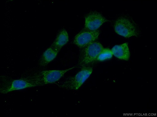 [15331-1-AP-20UL] MVD Polyclonal antibody