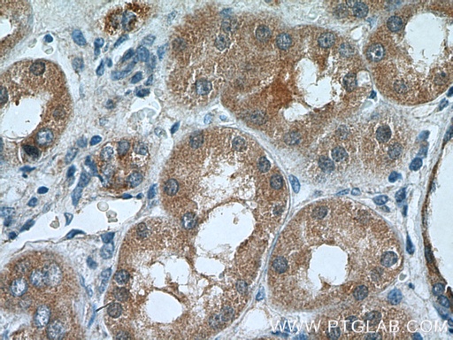 [15335-1-AP-20UL] TSTA3 Polyclonal antibody