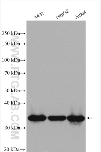 [15338-1-AP-150UL] MED6 Polyclonal antibody