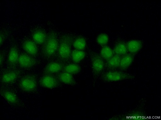 [15339-1-AP-150UL] POLR3D Polyclonal antibody