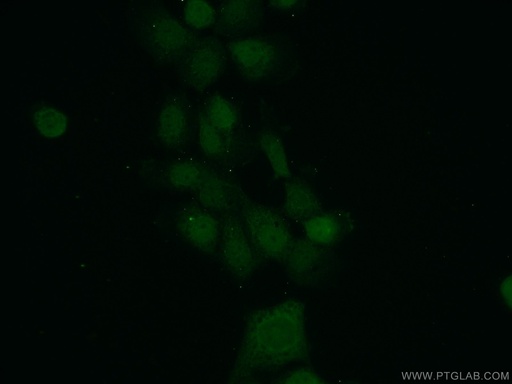 [15344-1-AP-20UL] MAD2L1BP Polyclonal antibody