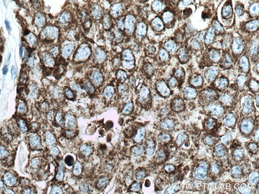 [15346-1-AP-150UL] CKMT1A Polyclonal antibody