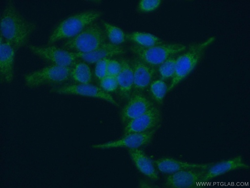 [15349-1-AP-150UL] CRIP1 Polyclonal antibody