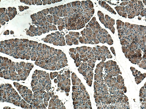 [15351-1-AP-150UL] TRIAP1 Polyclonal antibody