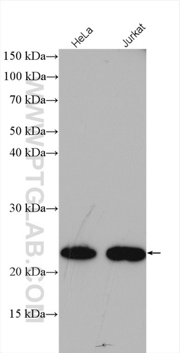 [15352-1-AP-150UL] MED18 Polyclonal antibody