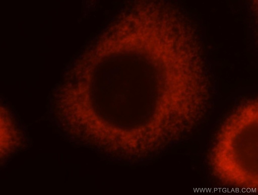 [15354-1-AP-20UL] MYL9 Polyclonal antibody