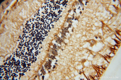 [15356-1-AP-150UL] RLBP1 Polyclonal antibody